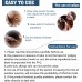 Curvecity Antiparasitic collars for animals Flea and Tick Collar for Large Dog, Prevention and Control of Pests on Dogs, Safe Natural Ingredients Protection, Waterproof, Free Flea Drop and Comb 2-Pack