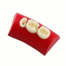 Forevertime Teeth filling material Tooth Cavity Filling and Inlay , Endodontic Root Canal Kit,Denta