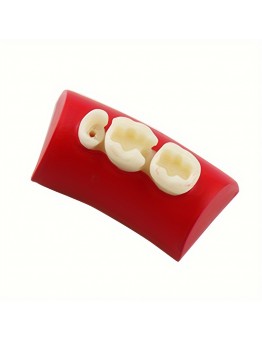 Forevertime Teeth filling material Tooth Cavity Filling and Inlay , Endodontic Root Canal Kit,Denta